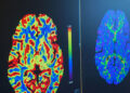 Why Subspecialized Radiology Is Reshaping Collaborative Care