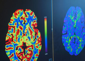 Why Subspecialized Radiology Is Reshaping Collaborative Care